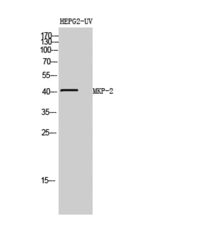 Western blot - MKP-2 Polyclonal Antibody from Signalway Antibody (41148) - Antibodies.com