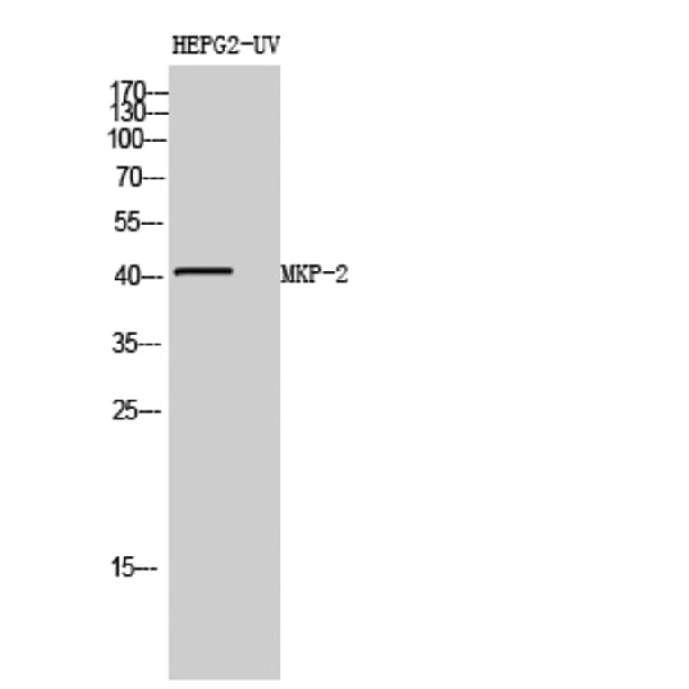Western blot - MKP-2 Polyclonal Antibody from Signalway Antibody (41148) - Antibodies.com