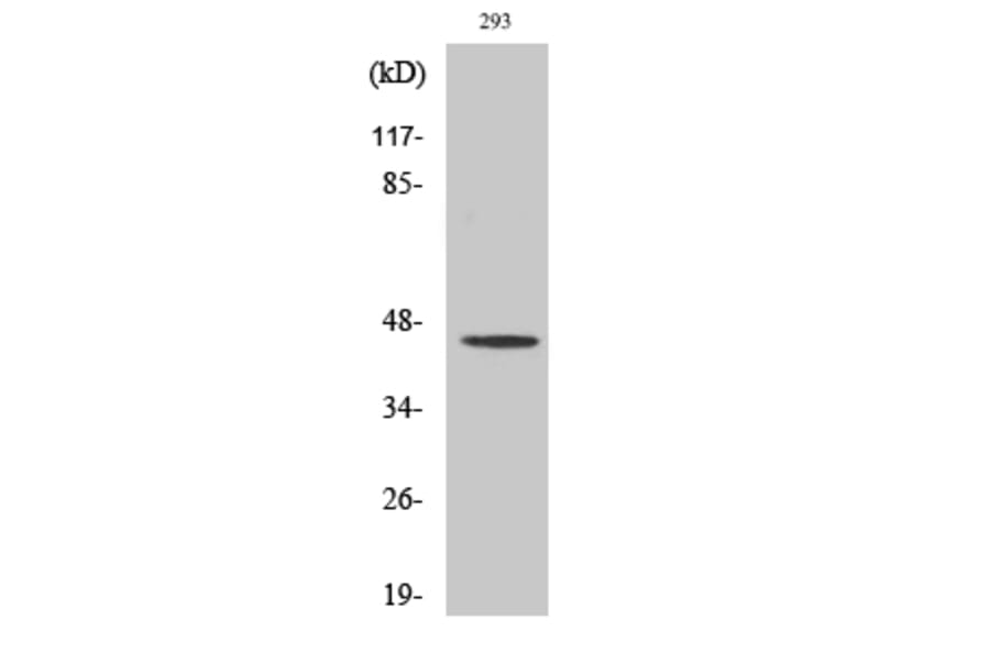 Western blot - MOR-1 Polyclonal Antibody from Signalway Antibody (41162) - Antibodies.com