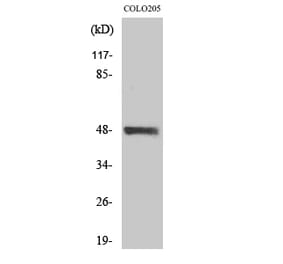 Western blot - MST-3 Polyclonal Antibody from Signalway Antibody (41185) - Antibodies.com