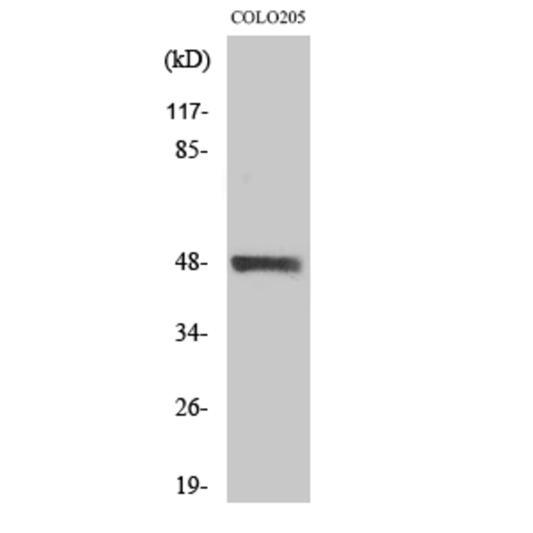 Western blot - MST-3 Polyclonal Antibody from Signalway Antibody (41185) - Antibodies.com
