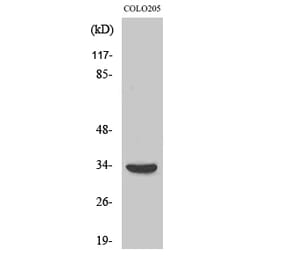 Western blot - MyD88 Polyclonal Antibody from Signalway Antibody (41191) - Antibodies.com