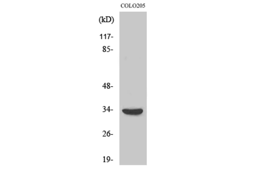 Western blot - MyD88 Polyclonal Antibody from Signalway Antibody (41191) - Antibodies.com