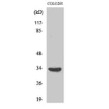 Western blot - MyD88 Polyclonal Antibody from Signalway Antibody (41191) - Antibodies.com