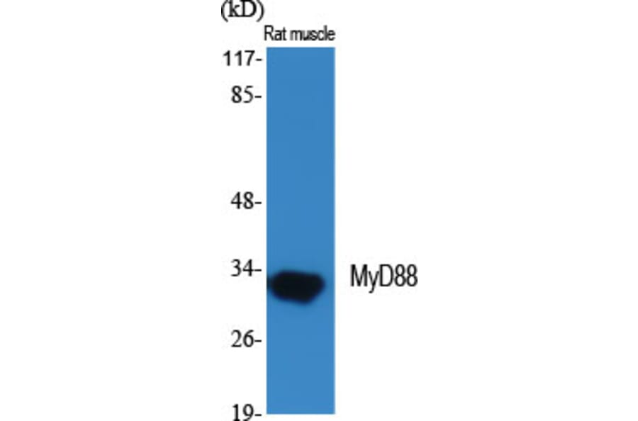 Western blot - MyD88 Polyclonal Antibody from Signalway Antibody (41191) - Antibodies.com