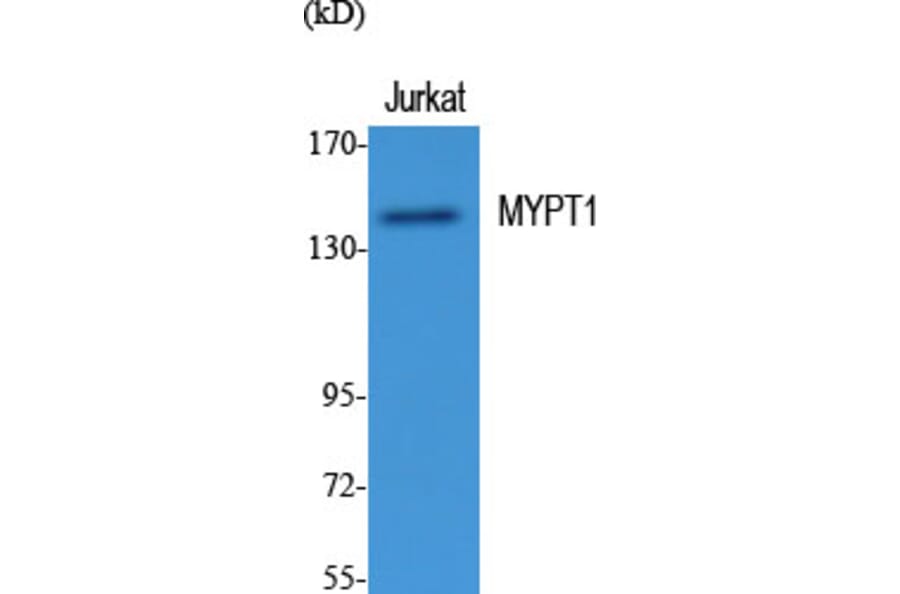 Western blot - MYPT1 Polyclonal Antibody from Signalway Antibody (41196) - Antibodies.com