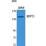 Western blot - MYPT1 Polyclonal Antibody from Signalway Antibody (41196) - Antibodies.com