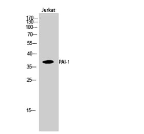 Western blot - PAI-1 Polyclonal Antibody from Signalway Antibody (41321) - Antibodies.com