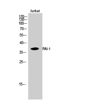 Western blot - PAI-1 Polyclonal Antibody from Signalway Antibody (41321) - Antibodies.com