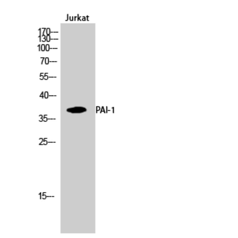 Western blot - PAI-1 Polyclonal Antibody from Signalway Antibody (41321) - Antibodies.com
