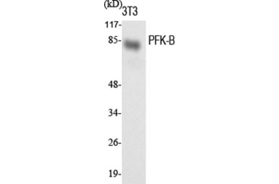 Western blot - PFK-B Polyclonal Antibody from Signalway Antibody (41333) - Antibodies.com