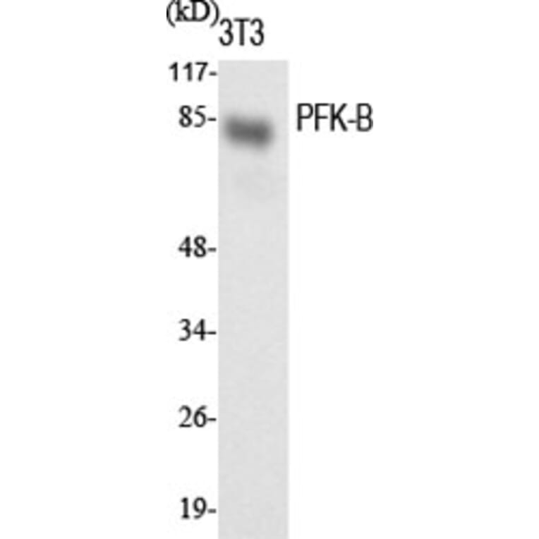 Western blot - PFK-B Polyclonal Antibody from Signalway Antibody (41333) - Antibodies.com
