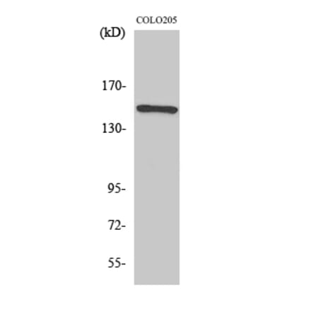 Western blot - Rad50 Polyclonal Antibody from Signalway Antibody (41380) - Antibodies.com