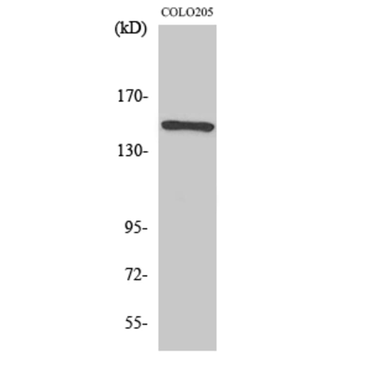 Western blot - Rad50 Polyclonal Antibody from Signalway Antibody (41380) - Antibodies.com