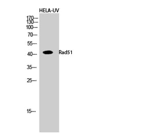 Western blot - Rad51 Polyclonal Antibody from Signalway Antibody (41381) - Antibodies.com