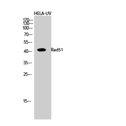 Western blot - Rad51 Polyclonal Antibody from Signalway Antibody (41381) - Antibodies.com