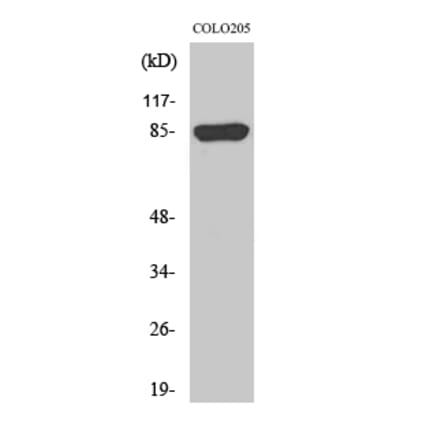 Western blot - REP-2 Polyclonal Antibody from Signalway Antibody (41393) - Antibodies.com