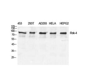 Western blot - Rsk-4 Polyclonal Antibody from Signalway Antibody (41418) - Antibodies.com