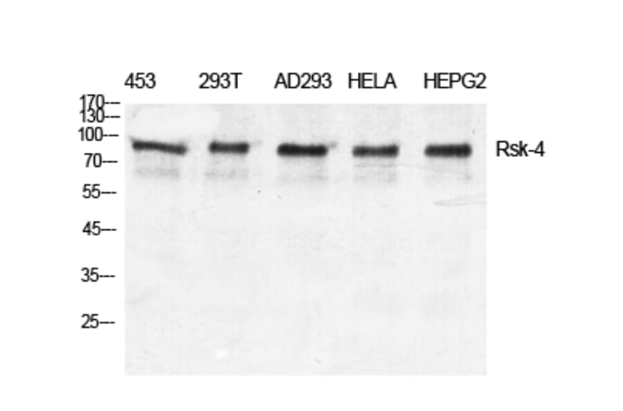 Western blot - Rsk-4 Polyclonal Antibody from Signalway Antibody (41418) - Antibodies.com