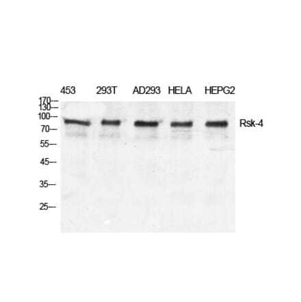 Western blot - Rsk-4 Polyclonal Antibody from Signalway Antibody (41418) - Antibodies.com