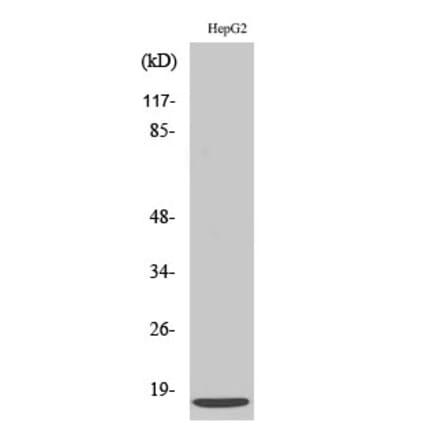 Western blot - SDF-1 Polyclonal Antibody from Signalway Antibody (41422) - Antibodies.com