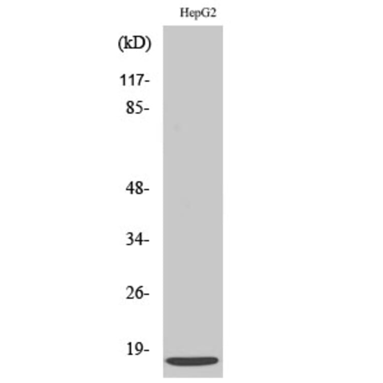 Western blot - SDF-1 Polyclonal Antibody from Signalway Antibody (41422) - Antibodies.com