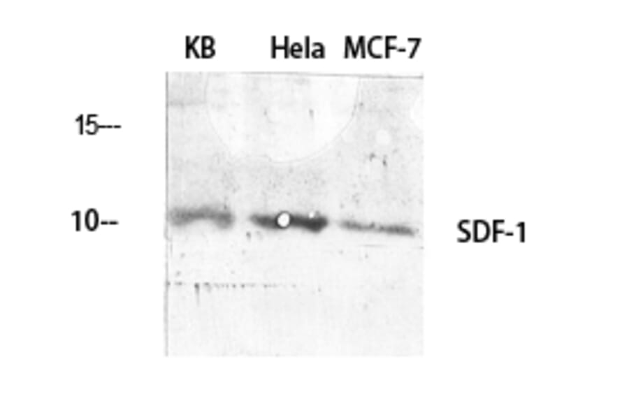 Western blot - SDF-1 Polyclonal Antibody from Signalway Antibody (41422) - Antibodies.com