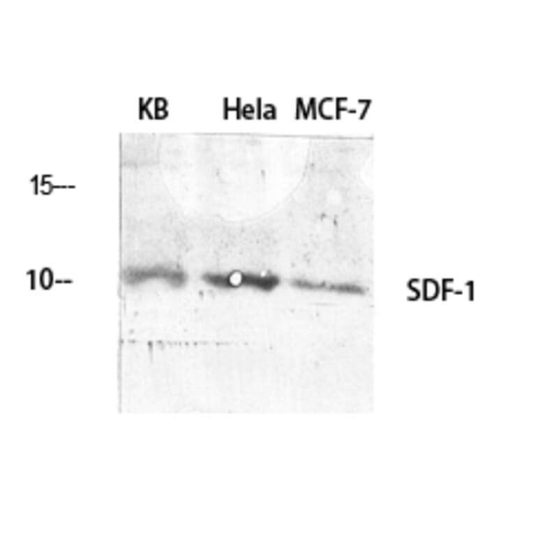 Western blot - SDF-1 Polyclonal Antibody from Signalway Antibody (41422) - Antibodies.com