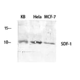 Western blot - SDF-1 Polyclonal Antibody from Signalway Antibody (41422) - Antibodies.com