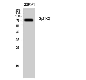 Western blot - SphK2 Polyclonal Antibody from Signalway Antibody (41454) - Antibodies.com