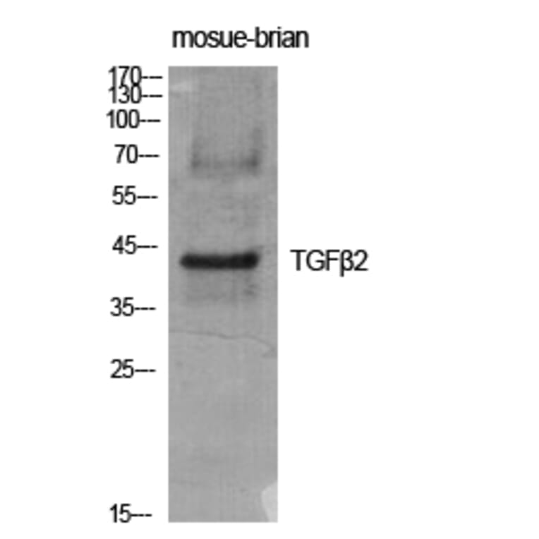 Western blot - TGFβ2 Polyclonal Antibody from Signalway Antibody (41495) - Antibodies.com