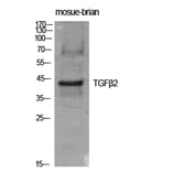 Western blot - TGFβ2 Polyclonal Antibody from Signalway Antibody (41495) - Antibodies.com