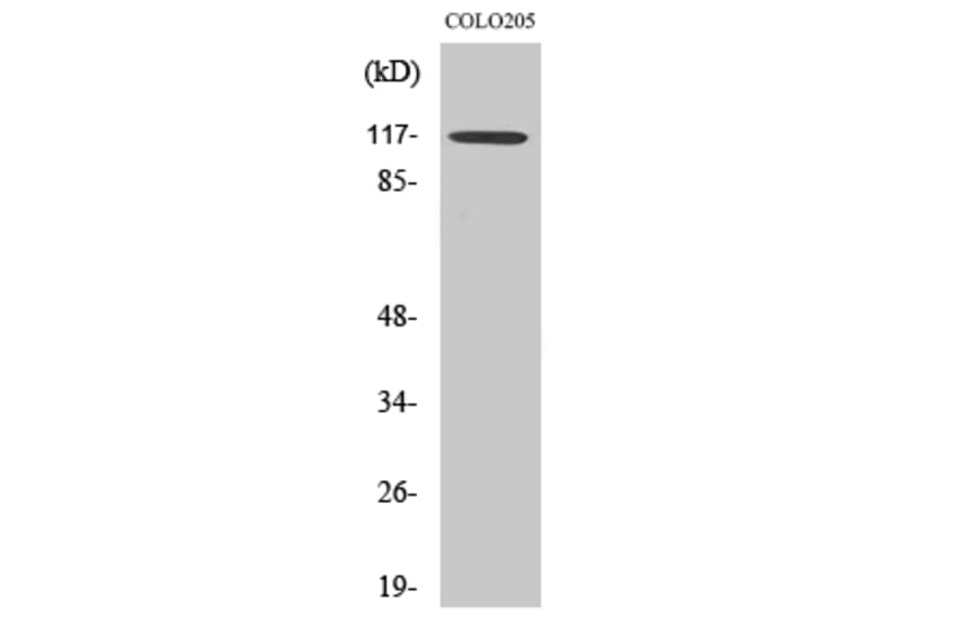 Western blot - TIF1α Polyclonal Antibody from Signalway Antibody (41498) - Antibodies.com