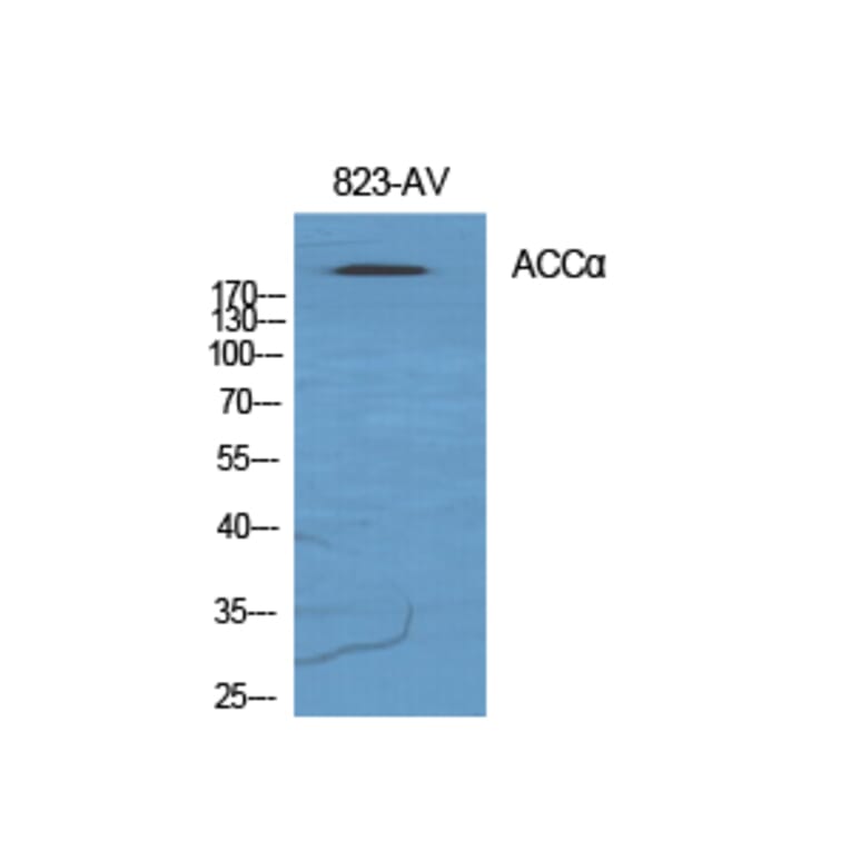 Western blot - ACCα Polyclonal Antibody from Signalway Antibody (40539) - Antibodies.com