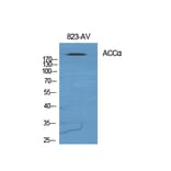 Western blot - ACCα Polyclonal Antibody from Signalway Antibody (40539) - Antibodies.com