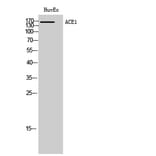 Western blot - ACE1 Polyclonal Antibody from Signalway Antibody (40540) - Antibodies.com