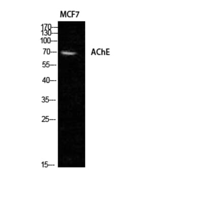 Western blot - AChE Polyclonal Antibody from Signalway Antibody (40541) - Antibodies.com