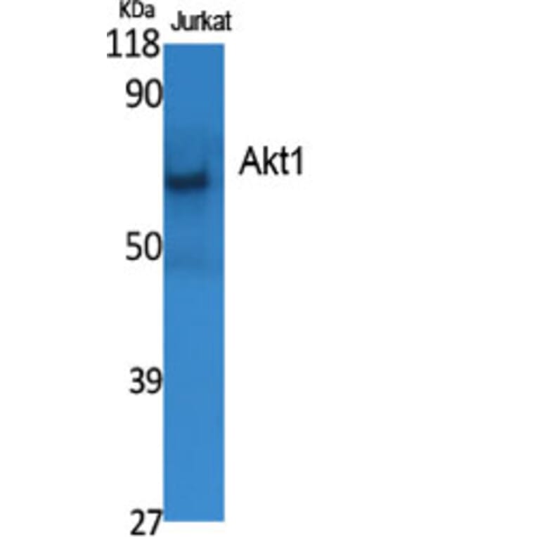 Western blot - Akt1 Polyclonal Antibody from Signalway Antibody (40574) - Antibodies.com