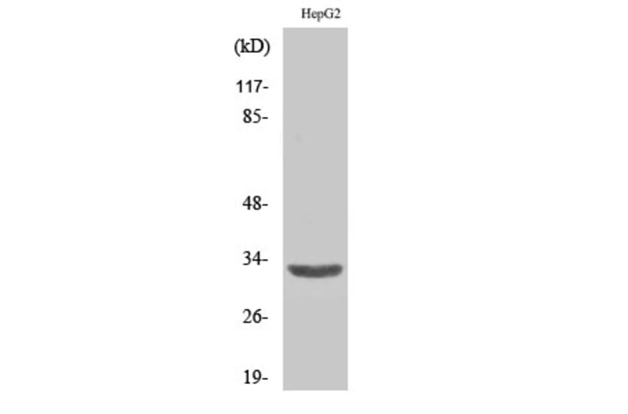 Western blot - ANT3 Polyclonal Antibody from Signalway Antibody (40595) - Antibodies.com