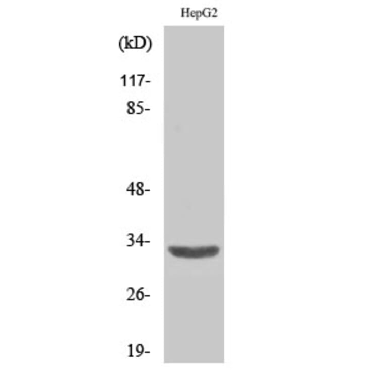 Western blot - ANT3 Polyclonal Antibody from Signalway Antibody (40595) - Antibodies.com