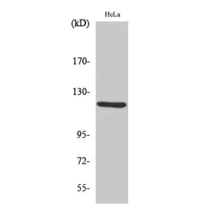 Western blot - AOX1 Polyclonal Antibody from Signalway Antibody (40597) - Antibodies.com