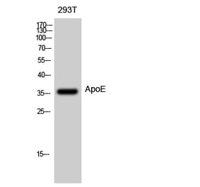 Western blot - ApoE Polyclonal Antibody from Signalway Antibody (40604) - Antibodies.com