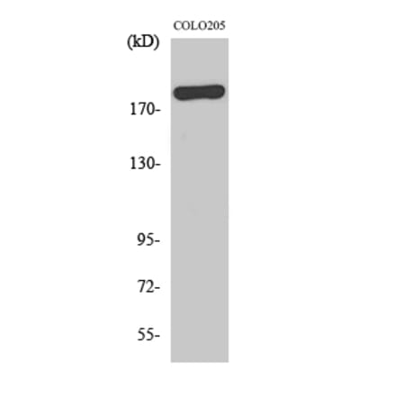 Western blot - BCoR Polyclonal Antibody from Signalway Antibody (40644) - Antibodies.com