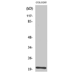 Western blot - BET3 Polyclonal Antibody from Signalway Antibody (40645) - Antibodies.com