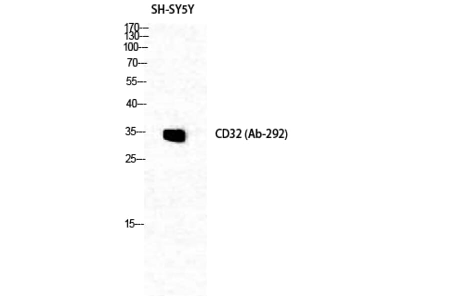 Western blot - CD32 Polyclonal Antibody from Signalway Antibody (40700) - Antibodies.com
