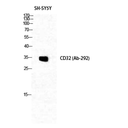 Western blot - CD32 Polyclonal Antibody from Signalway Antibody (40700) - Antibodies.com