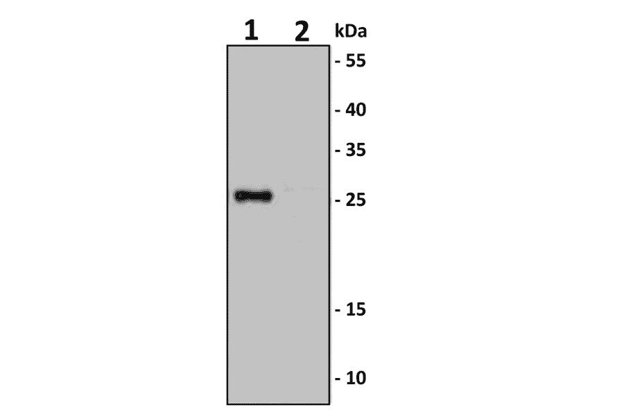 IL-6 Antibody KO Validation - Human IL-6 ELISA Kit (High Sensitivity) (A350897) - Antibodies.com