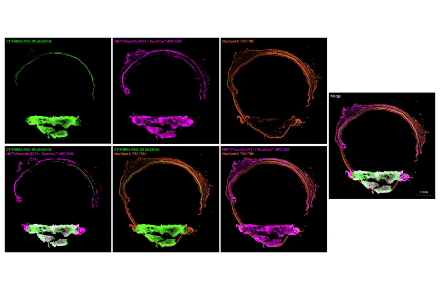 Immunofluorescence - Anti-PSD95 Antibody [rK28/43] (CF®640R) (A352070) - Antibodies.com