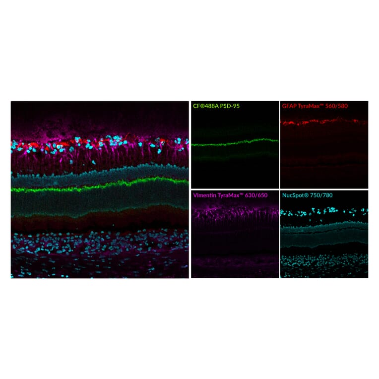 Immunofluorescence - Anti-PSD95 Antibody [rK28/43] (CF®647) (A352071) - Antibodies.com
