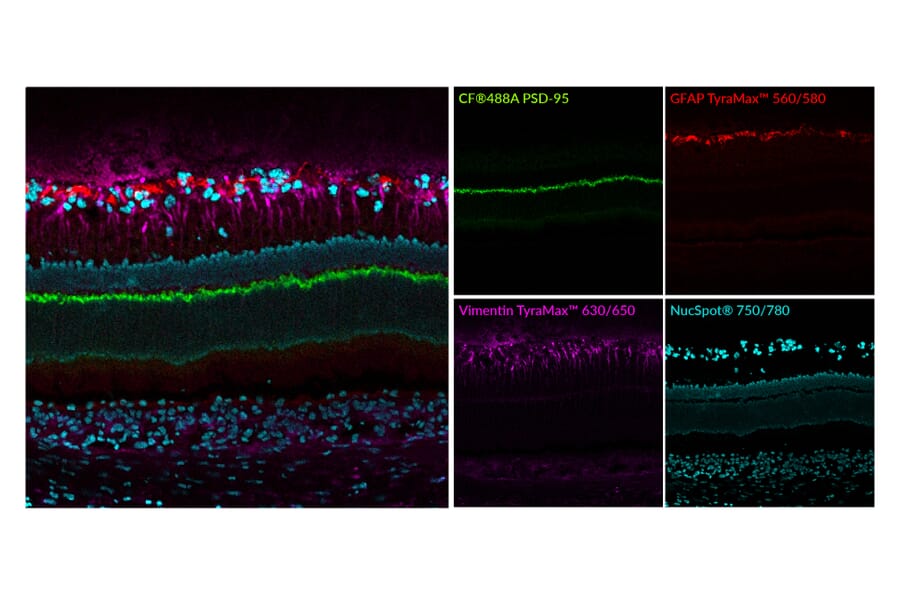 Immunofluorescence - Anti-PSD95 Antibody [rK28/43] (CF®740) (A352073) - Antibodies.com